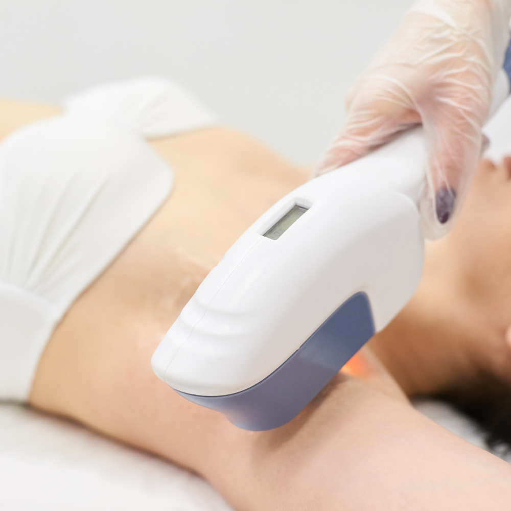 Arm Fat Reduction & Toning Therapy